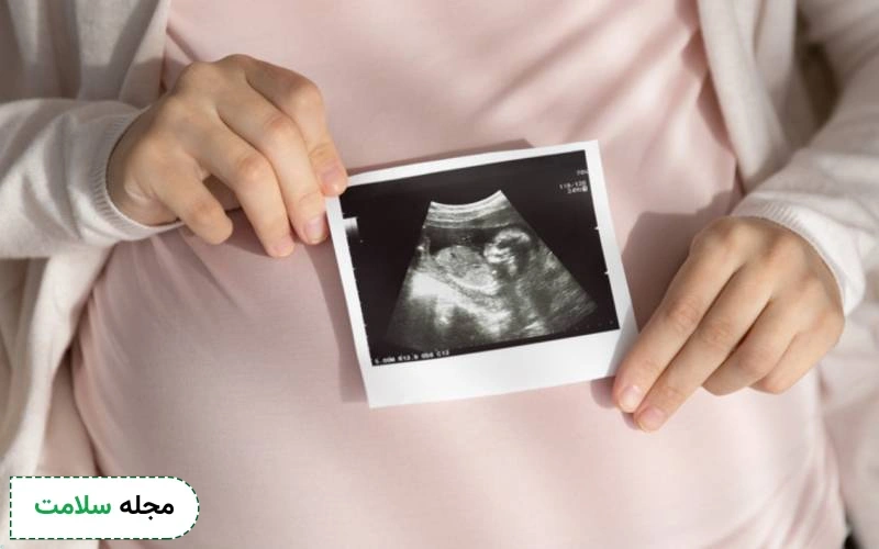 بریچ جنین چیست و چگونه اتفاق می افتد؟ آیا راه درمانی دارد؟