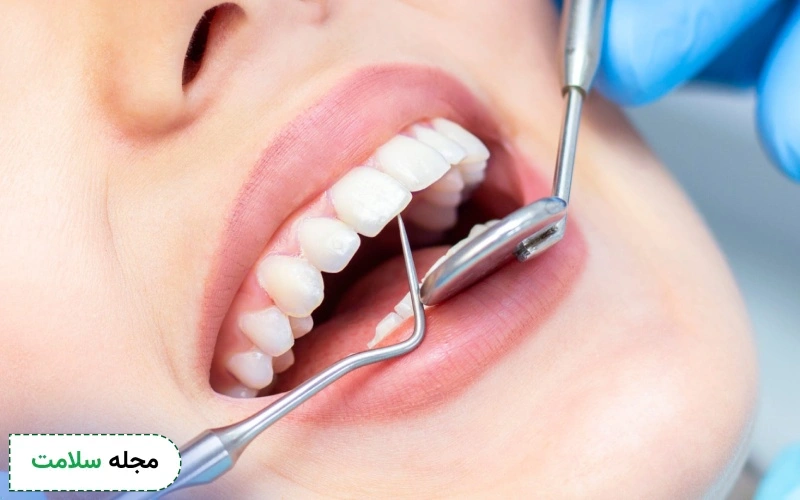 چگونه بهترین نوع روکش دندانی را انتخاب کنیم؟