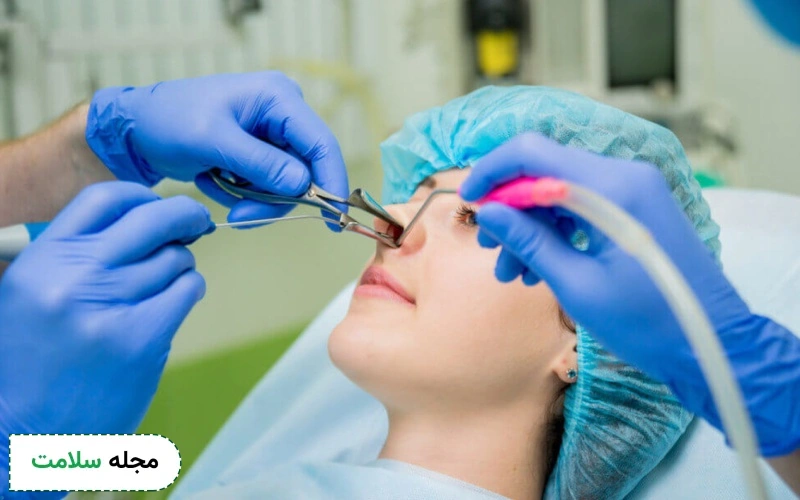 عمل بسته بینی چگونه است؟