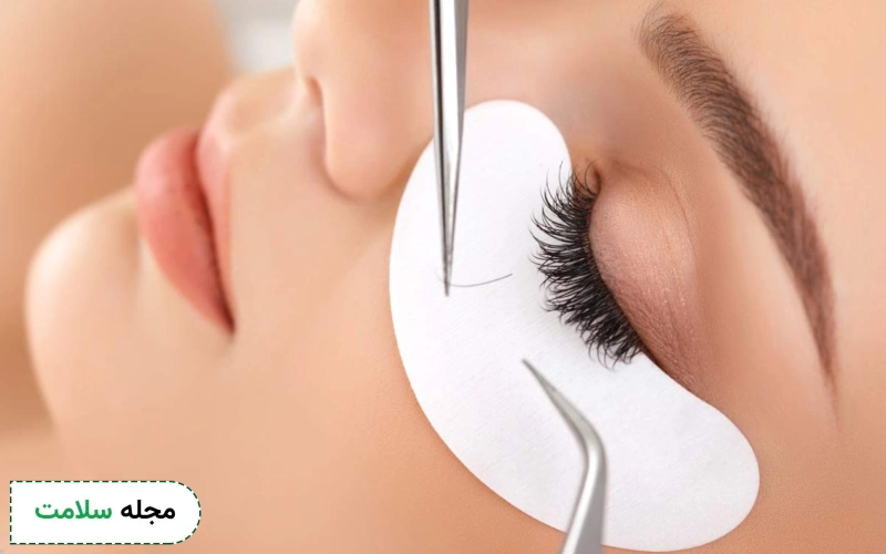 کاشت مژه گربه ای چقدر طول میکشد؟
