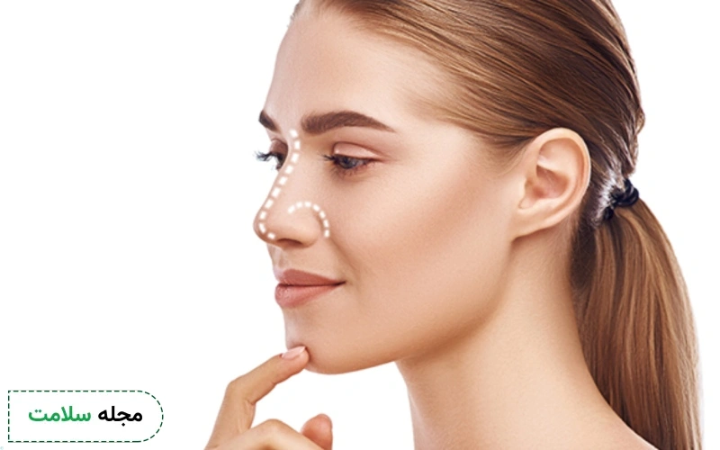 عمل باز بینی برای چه کسانی مناسب نیست؟