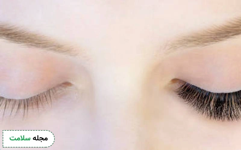 ماندگاری کاشت مژه والیوم چقدر است؟