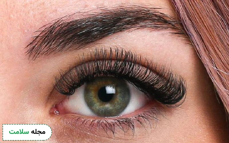کاشت مژه والیوم و مزایا و محدودیت های آن