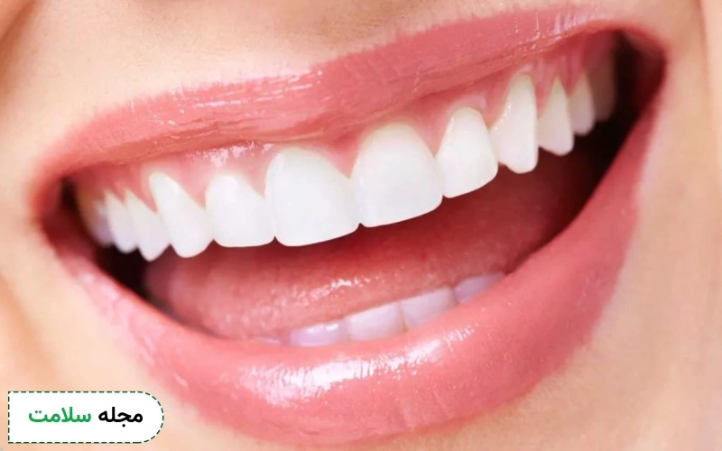 بهترین روش پیشگیری از تغییر رنگ لمینت کدام است؟