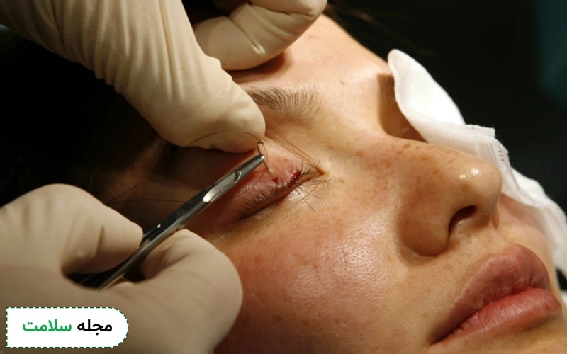 مراقبت های کاشت مژه دائم