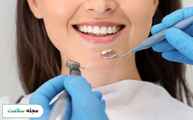 لمینت برای اصلاح دندان خرگوشی فایده ای دارد؟