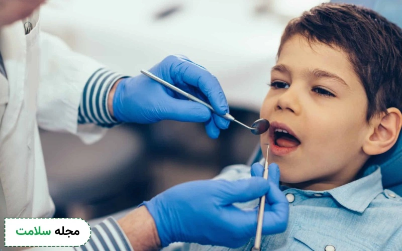 لمینت دندان از چه سنی انجام میشود؟