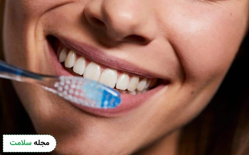 بهداشت دهان و دندان برای لمینت مهم است؟