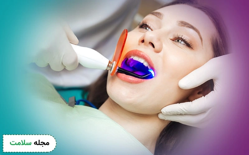 قیمت سفید کردن دندان با لیزر نسبت به لمینت کمتر است.