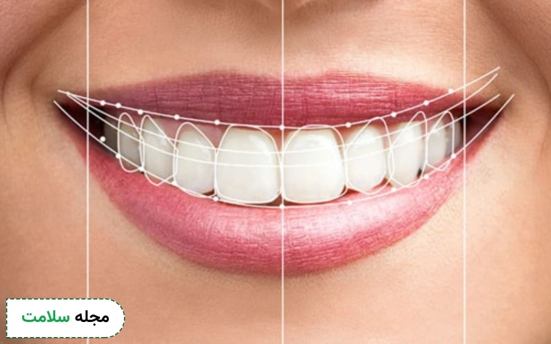 حفظ سلامت پریودنتال را در اولویت قرار دهید.