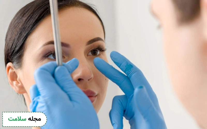 بینی نیمه فانتزی نوک تیز خوب است؟