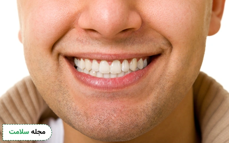 کامپوزیت چیست؟
