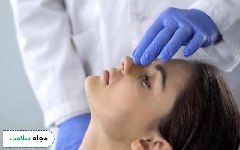 نحوه انجام عمل باز بینی چگونه است؟