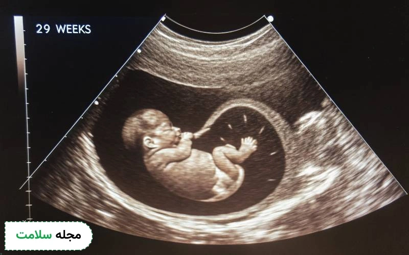  عکس سونوگرافی جنین در هفته 29 