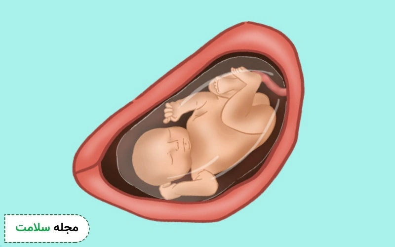 هفته 32 بارداری: علائم مادر، وزن جنین و نکات مراقبتی این هفته