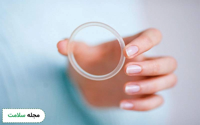 حلقه ضد بارداری واژینال برای چه افرادی مناسب است؟
