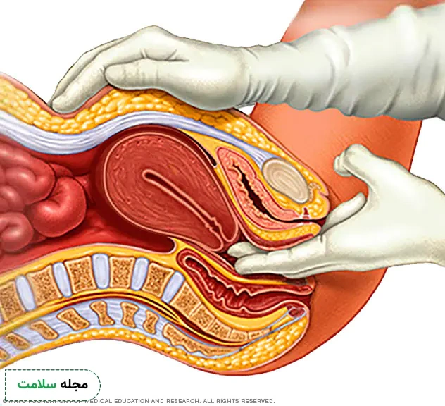 vaginal prolapse diagnosis