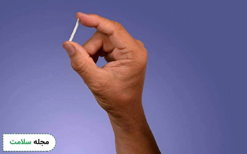 ایمپلنت جلوگیری از بارداری چگونه عمل می کند؟