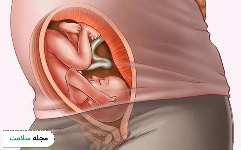 عکس جنین ۲۹ هفته دختر