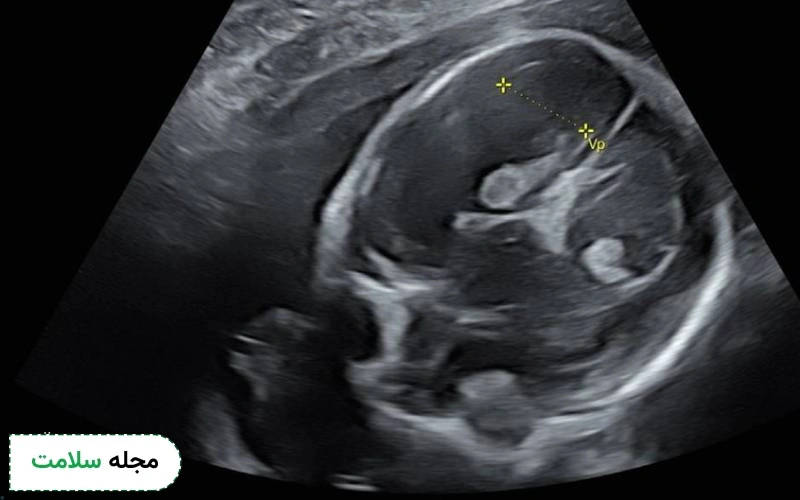 عکس جنین ۲۷ هفته دختر در سونوگرافی