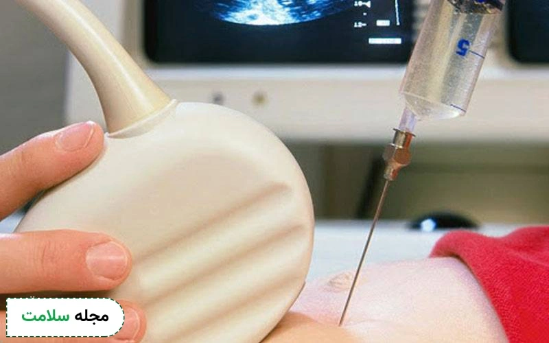 باید و نبایدهای هفته نوزدهم بارداری