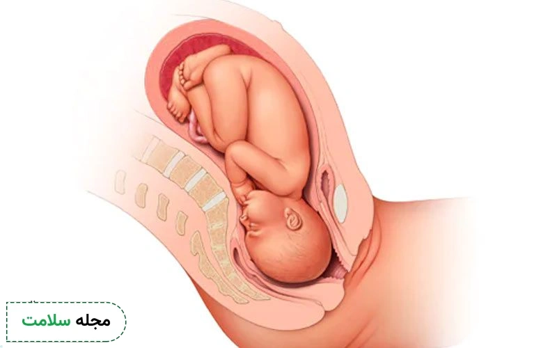 عکس جنین ۳۶ هفته