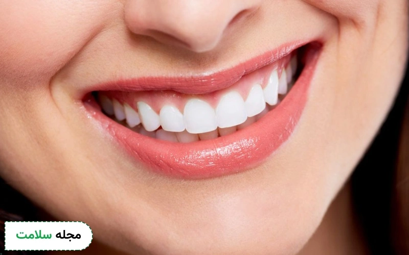 انواع ایمپلنت کره ای + مزایا و معایب آنها