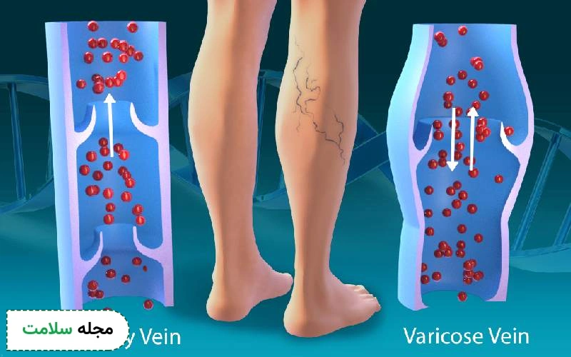 خون سیاهرگ چه رنگی است؟