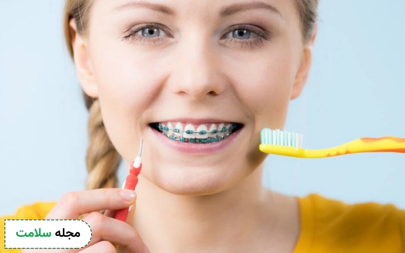 مسواک مخصوص ارتودنسی چیست و چه کاربردی دارد؟