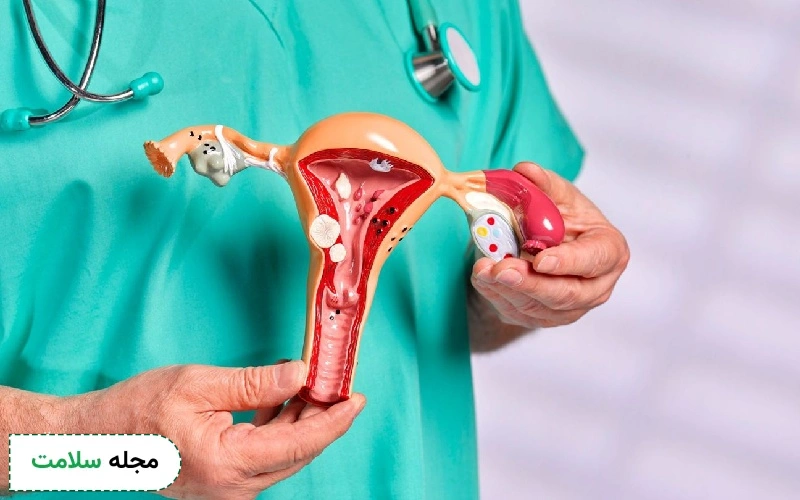 چه بیماری هایی باعث دوبار پریود شدن در یک ماه میشود؟

