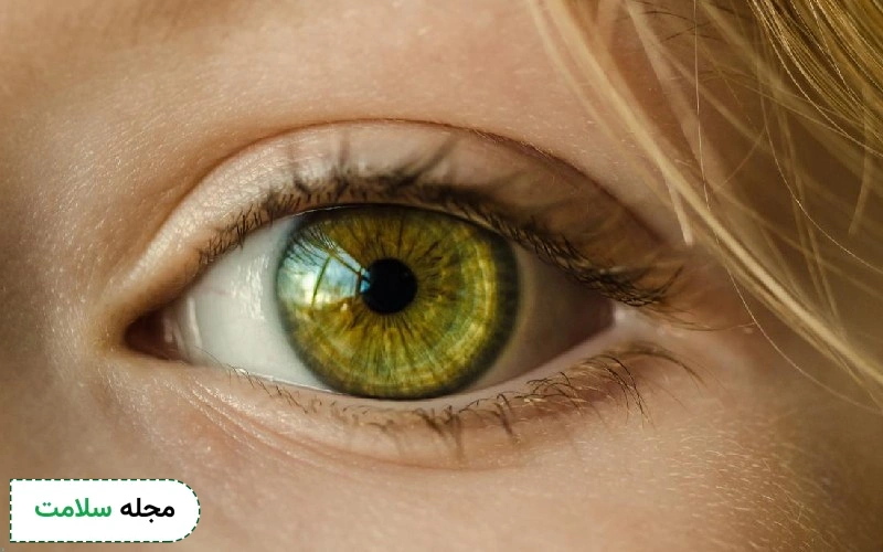 عمل تغییر رنگ چشم ، یک آرزوی محال یا واقعی؟