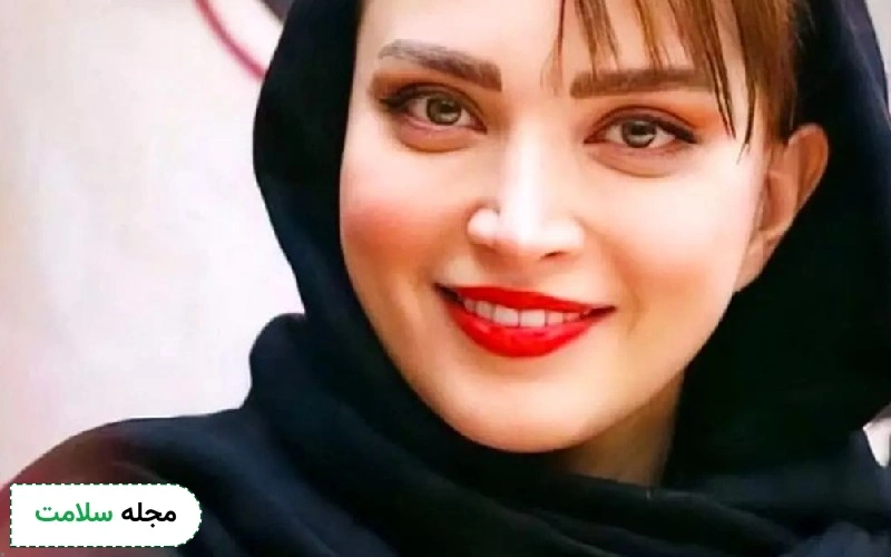 عمل چشم گربه ای بهنوش طباطبایی