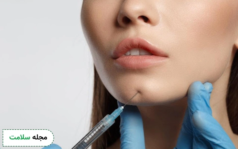 آنچه باید درباره ژل چانه، کاربرد و عوارض آن بدانید