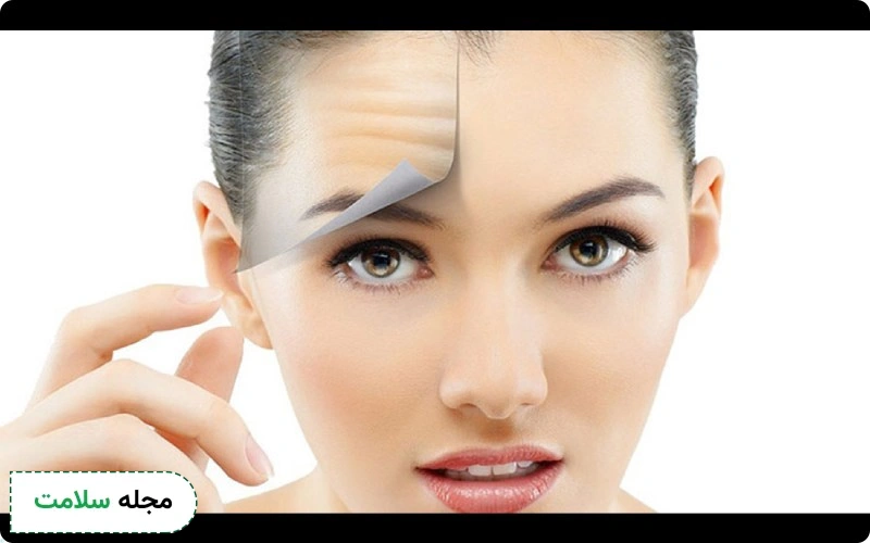 مزایای لیفت پیشانی متنوع است.