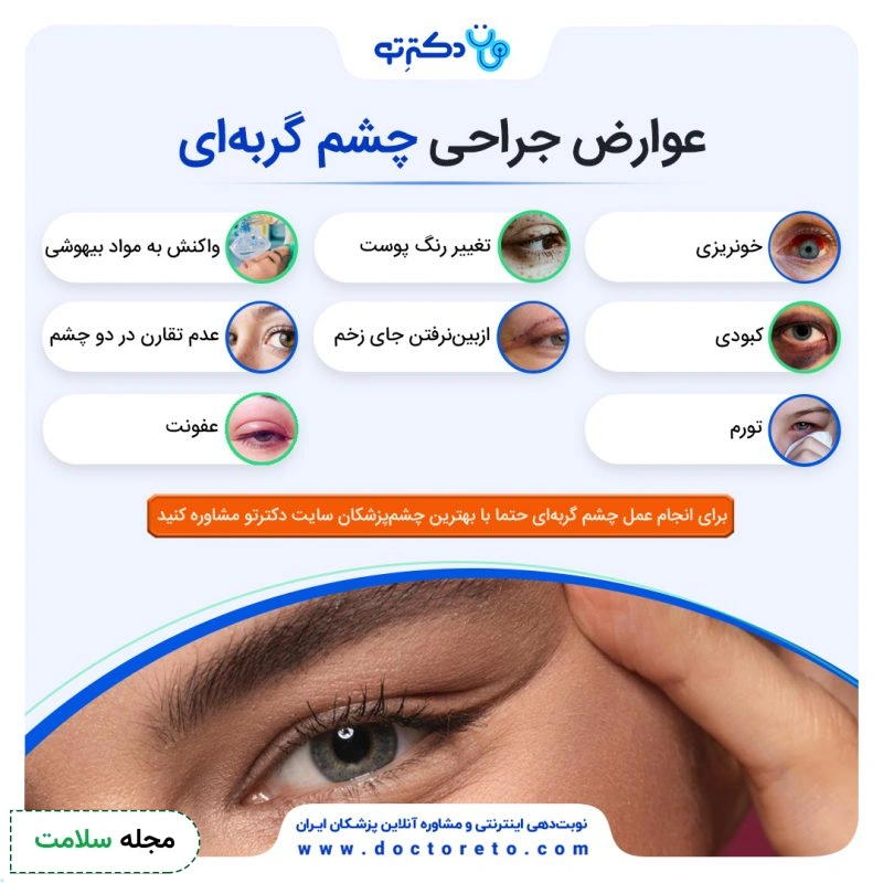 اینفوگرافی عوارض جراحی چشم گربه ای