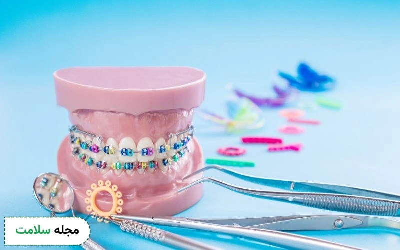 نحوه انجام ارتودنسی به چه صورت است؟