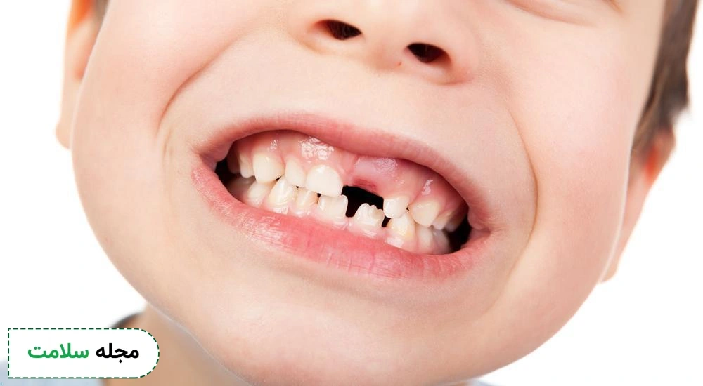 دندان های دائمی چگونه در می آیند؟