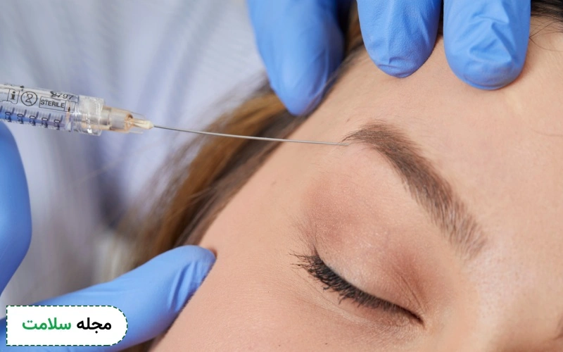 لیفت چشم با تزریق ژل چگونه است؟