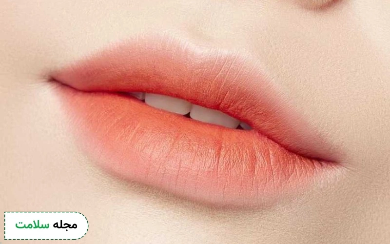 تزریق ژل لب باربی