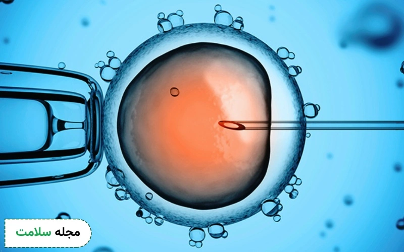 همه نکاتی که باید درباره آی وی اف (ivf) بدانید