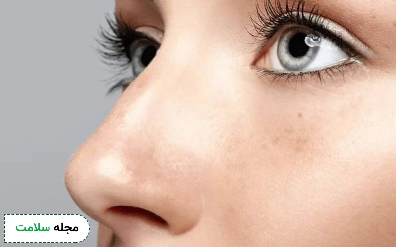 چسب لیفت بینی برای بینی استخوانی مناسب است؟