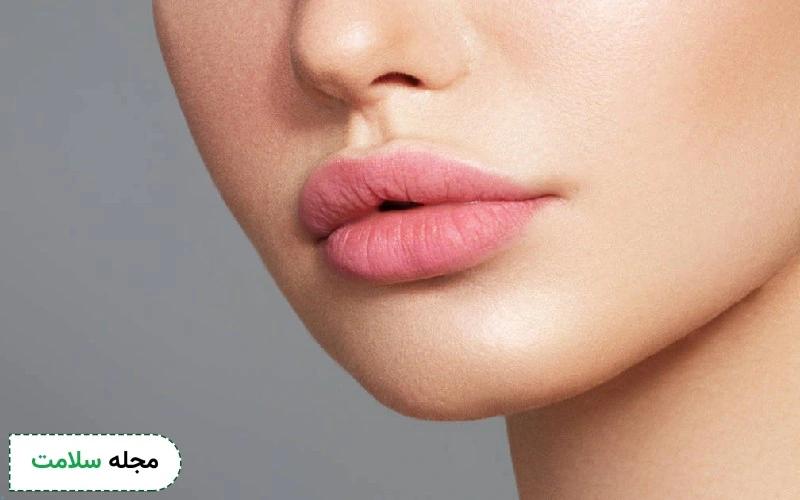 تزریق ژل لب قلوه ای