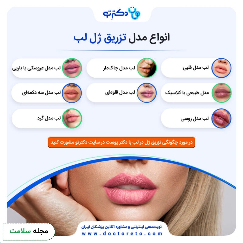 اینفوگرافی انواع مدل ژل لب
