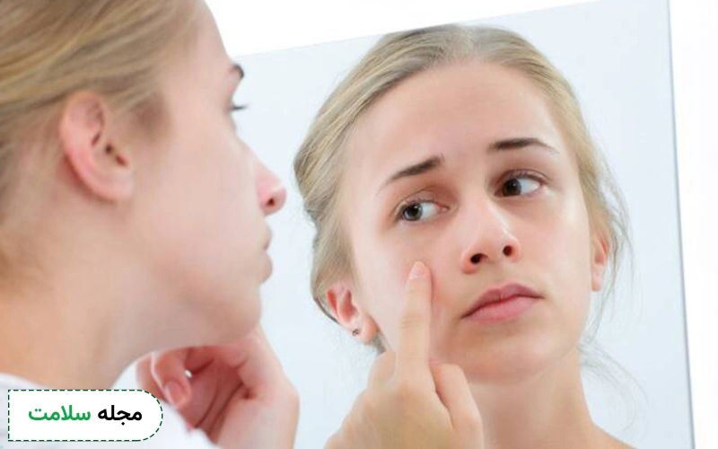 علت اختلال بدریختی بدن چیست؟