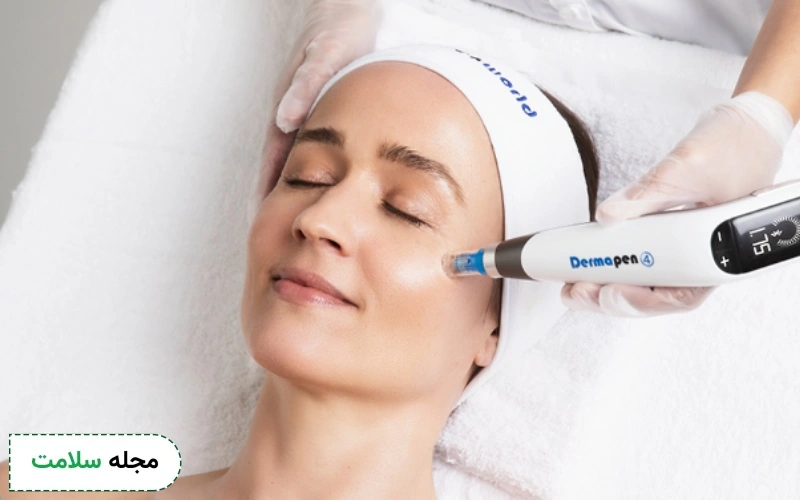 میکرونیدلینگ برای چه افرادی مناسب است؟