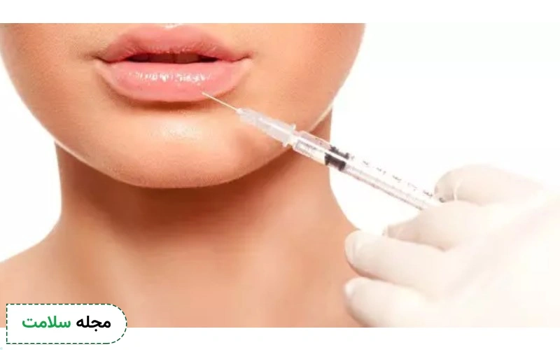 تزریق ژل لب عروسکی