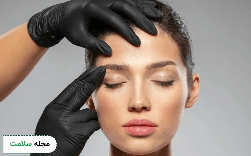 عکس لیفت شقیقه