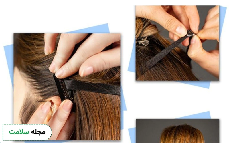 لیفت چشم با کش چیست؟
