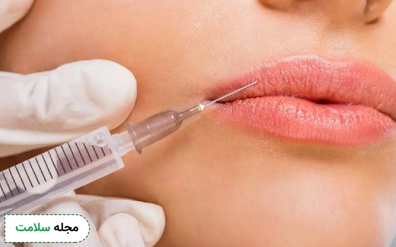 ژل لب عروسکی و باربی برای چه صورت هایی مناسب است؟ عوارض آن چیست؟
