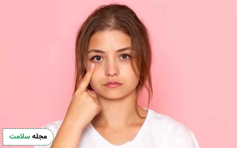 علائم کبد چرب بر روی پوست و چهره را چطور تشخیص دهیم؟